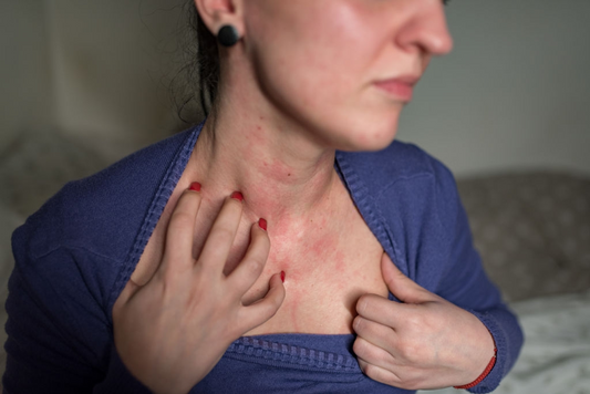 Discover the Underlying Problems of Dry Skin