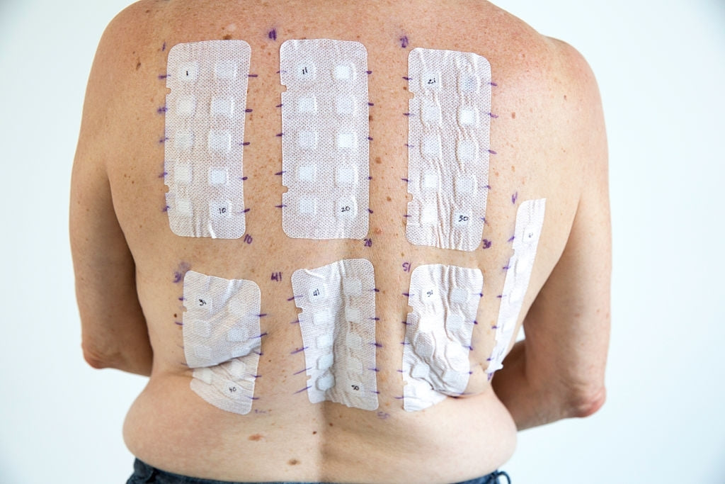 Do Weight Loss Patches Really Work?