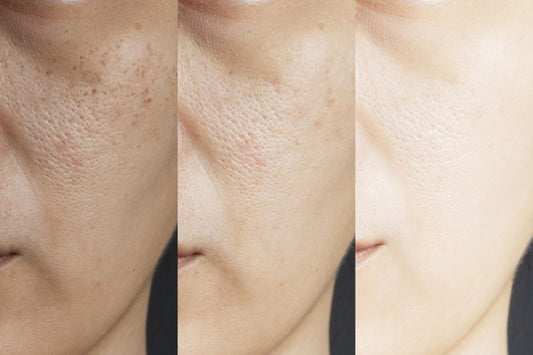 Treatment for the Most Common Skin Conditions